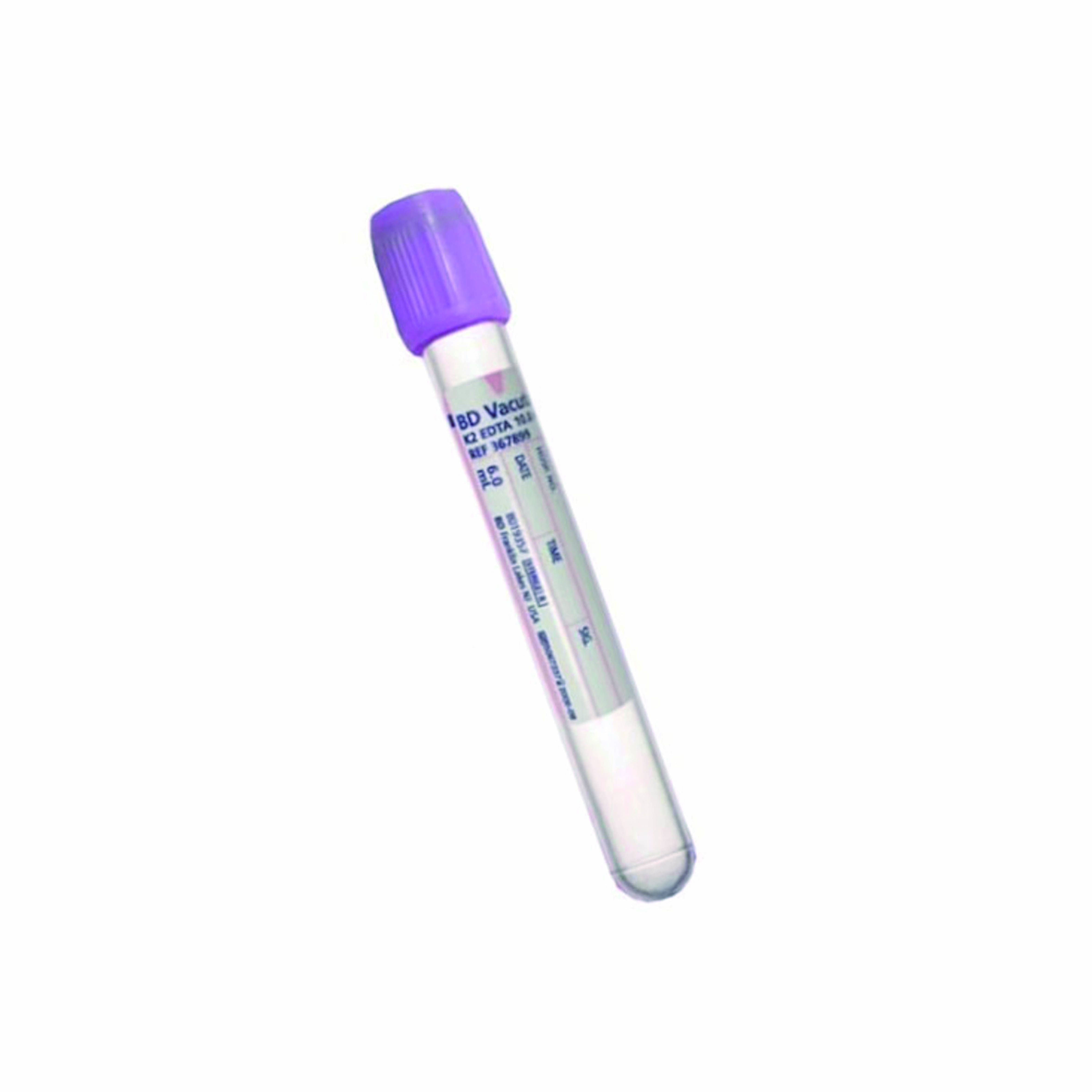 6ml（K2-EDTA）真空抗凝紫盖管 塑料EDTA采血管 科研用