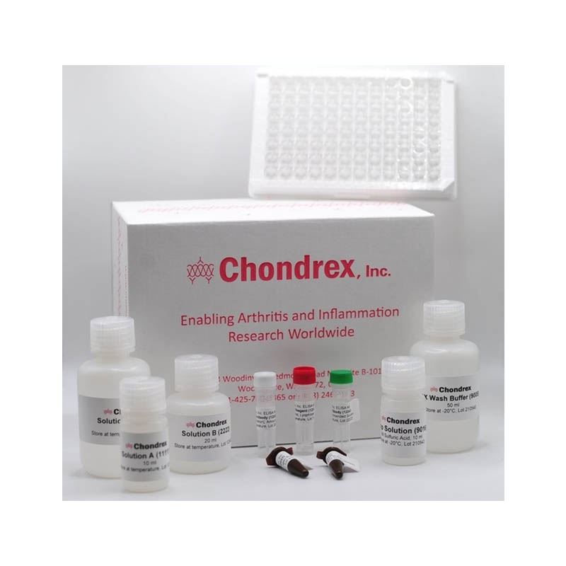 小鼠总IgE （IgEa和IgEb）检测试剂盒 Mouse Total IgE (IgEa and IgEb) Detection Kit